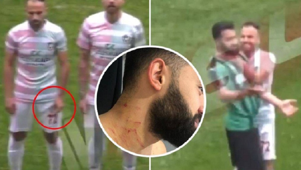 Τούρκος παίκτης χαράκωσε αντίπαλο έχοντας κρυμμένο ξυραφάκι (VIDEO)