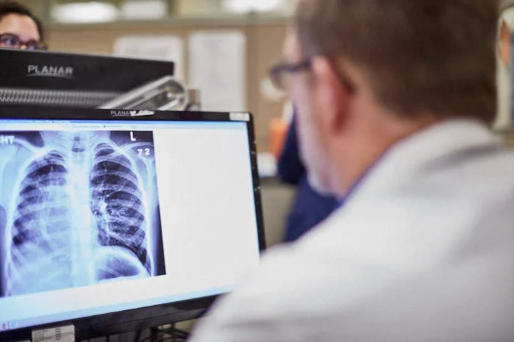 ΗΠΑ: Διπλή μεταμόσχευση πνευμόνων σε ασθενή που έπασχε από καρκίνο στο τελευταίο στάδιο