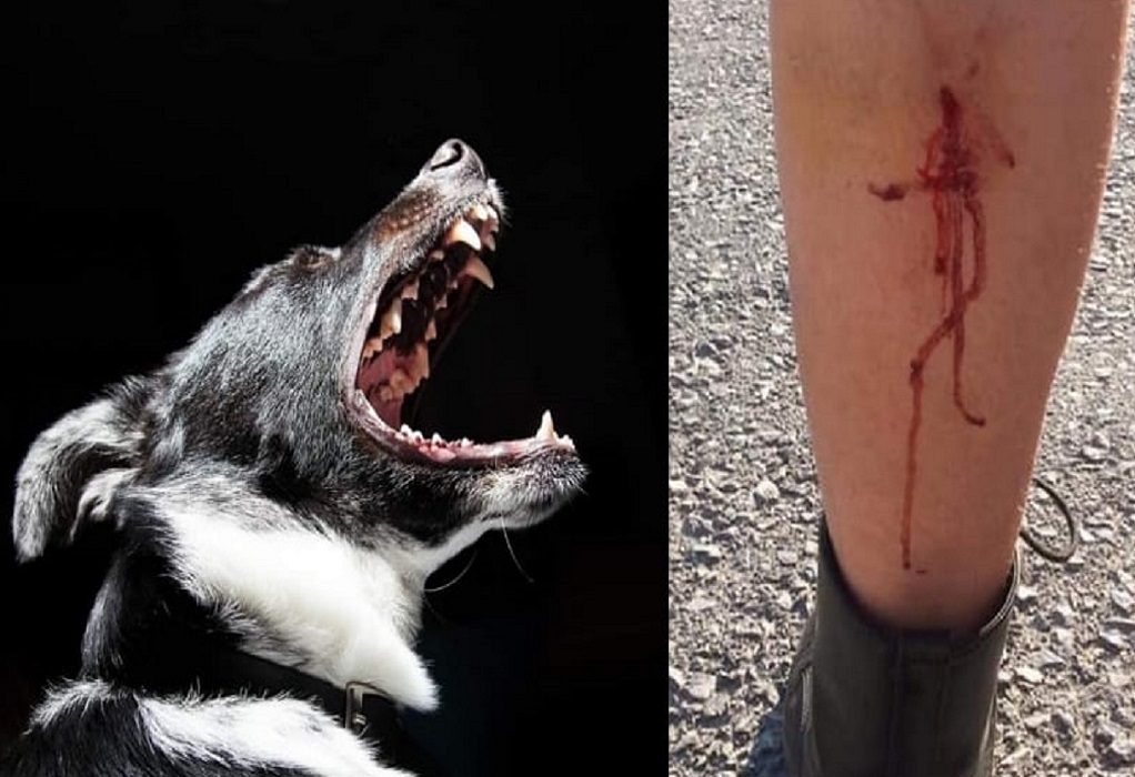 Θεσσαλονίκη: 18 επιθέσεις σκύλων σε ένα μήνα – Σήμερα επιχείρηση απομάκρυνσής τους