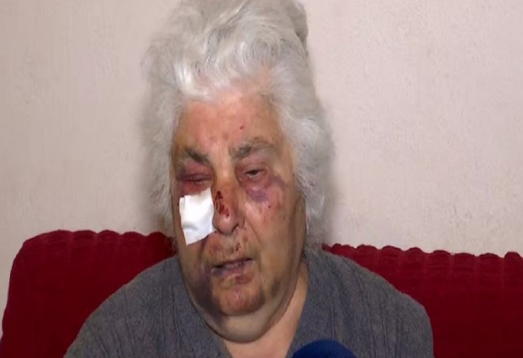 Σοκάρει η μαρτυρία ηλικιωμένης στο Αιγάλεω: Τη χτύπησαν άγρια ληστές στο σπίτι της (VIDEO)