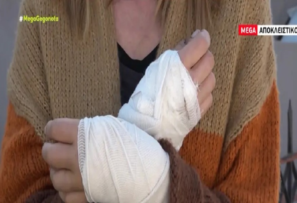 Γλυκά Νερά: Γυναίκα δέχθηκε άγρια επίθεση από πίτμπουλ-«Τα χέρια μου αχρηστεύτηκαν» (VIDEO)