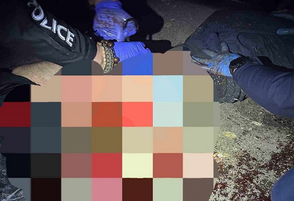 Πυροβολισμοί στην Ξηροκρήνη: Αστυνομικοί έκαναν τουρνικέ στον 31χρονο-«Κομβικής σημασίας η συνδρομή, έχανε πολύ αίμα» (ΦΩΤΟ)
